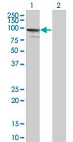 ZNF274 Antibody in Western Blot (WB)