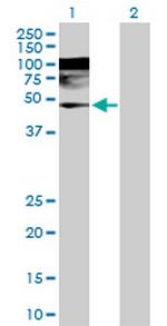 WDR4 Antibody in Western Blot (WB)