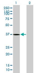 SLC17A3 Antibody in Western Blot (WB)