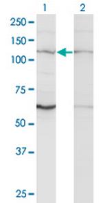 ZNF268 Antibody in Western Blot (WB)