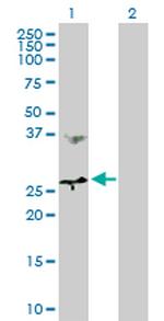 MTHFD2 Antibody in Western Blot (WB)