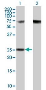 RPP40 Antibody in Western Blot (WB)