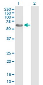 WASF3 Antibody in Western Blot (WB)