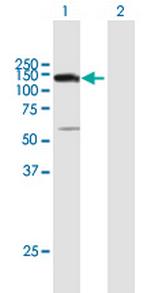 UTP14A Antibody in Western Blot (WB)