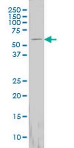 FTCD Antibody in Western Blot (WB)