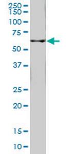 FTCD Antibody in Western Blot (WB)