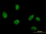 RUVBL2 Antibody in Immunocytochemistry (ICC/IF)