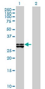 DHRS4 Antibody in Western Blot (WB)