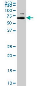 MAGED2 Antibody in Western Blot (WB)