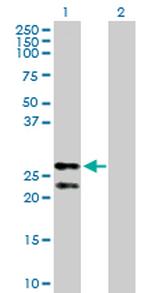 PRDX3 Antibody in Western Blot (WB)