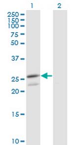 PRDX3 Antibody in Western Blot (WB)