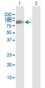 OS9 Antibody in Western Blot (WB)