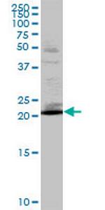 RAB32 Antibody in Western Blot (WB)