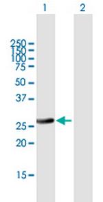 RAB32 Antibody in Western Blot (WB)