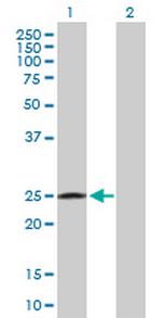 RAB32 Antibody in Western Blot (WB)