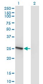 RAB32 Antibody in Western Blot (WB)