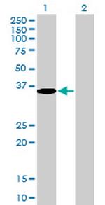 SDS Antibody in Western Blot (WB)