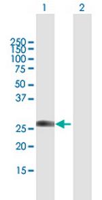 RBPMS Antibody in Western Blot (WB)