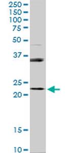 RAB31 Antibody in Western Blot (WB)