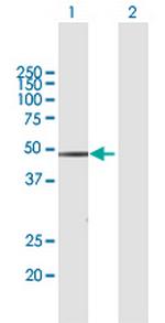 WWP2 Antibody in Western Blot (WB)