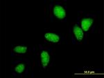 UBE2C Antibody in Immunocytochemistry (ICC/IF)