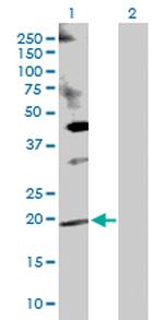 DUSP14 Antibody in Western Blot (WB)