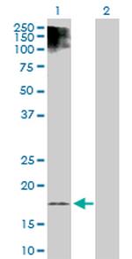 ESM1 Antibody in Western Blot (WB)