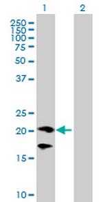 CD160 Antibody in Western Blot (WB)