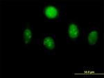 MYST2 Antibody in Immunocytochemistry (ICC/IF)