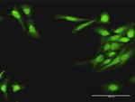 HRASLS3 Antibody in Immunocytochemistry (ICC/IF)