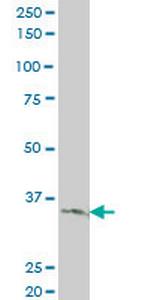 LDB3 Antibody in Western Blot (WB)