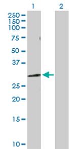 NUDT5 Antibody in Western Blot (WB)