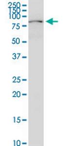 PKP3 Antibody in Western Blot (WB)