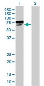 CHEK2 Antibody in Western Blot (WB)