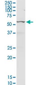 CHEK2 Antibody in Western Blot (WB)