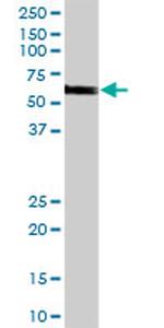 CHEK2 Antibody in Western Blot (WB)