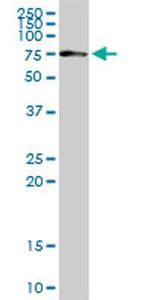 CHEK2 Antibody in Western Blot (WB)