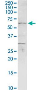 CHEK2 Antibody in Western Blot (WB)