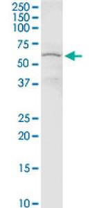 CHEK2 Antibody in Western Blot (WB)