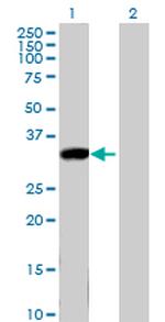 KLK8 Antibody in Western Blot (WB)