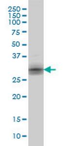 KLK8 Antibody in Western Blot (WB)