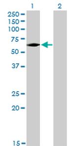 IRAK3 Antibody in Western Blot (WB)