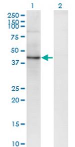 SEC63 Antibody in Western Blot (WB)