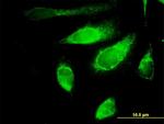 POLG2 Antibody in Immunocytochemistry (ICC/IF)