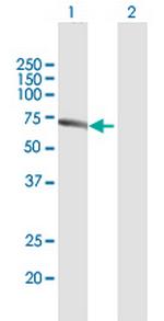 PACSIN2 Antibody in Western Blot (WB)