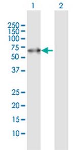 PACSIN2 Antibody in Western Blot (WB)