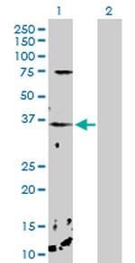 CHP Antibody in Western Blot (WB)