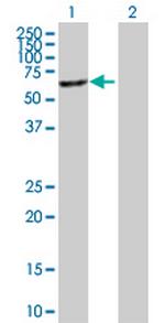 MGAT4B Antibody in Western Blot (WB)