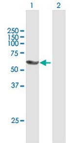 PNKP Antibody in Western Blot (WB)