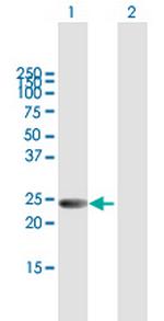 LYPLA2 Antibody in Western Blot (WB)